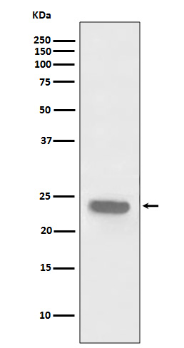 Rabbit monoclonal antibody