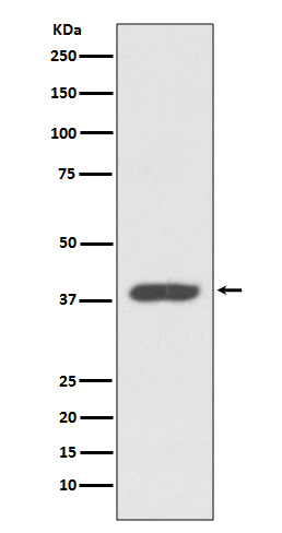 Rabbit monoclonal antibody