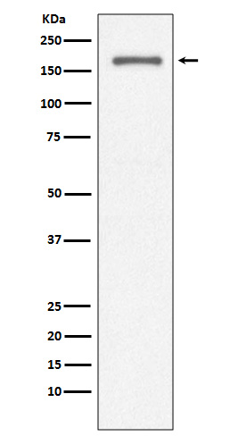 Rabbit monoclonal antibody