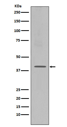 Rabbit monoclonal antibody
