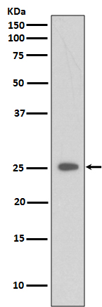 Rabbit monoclonal antibody
