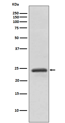 Rabbit monoclonal antibody