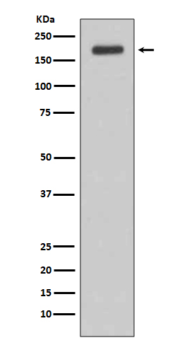 Rabbit monoclonal antibody