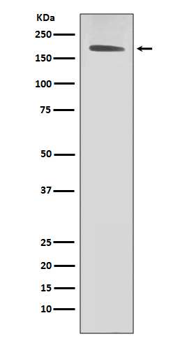 Rabbit monoclonal antibody