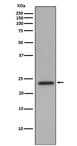 Rabbit monoclonal antibody