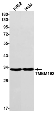 Rabbit monoclonal antibody