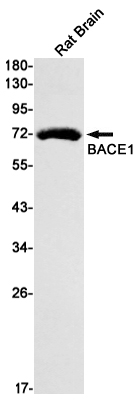 Rabbit monoclonal antibody
