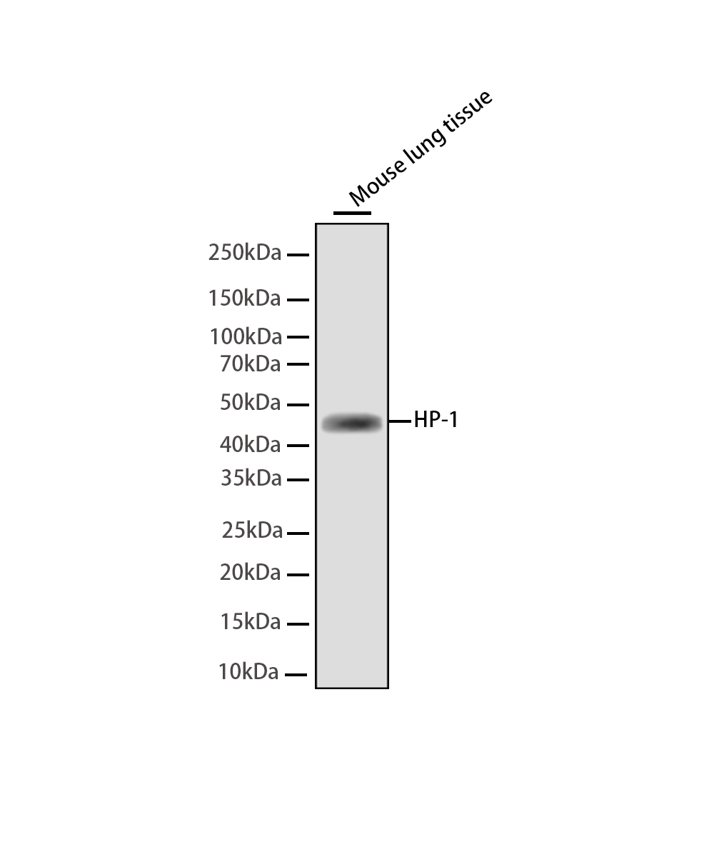 Rabbit monoclonal antibody
