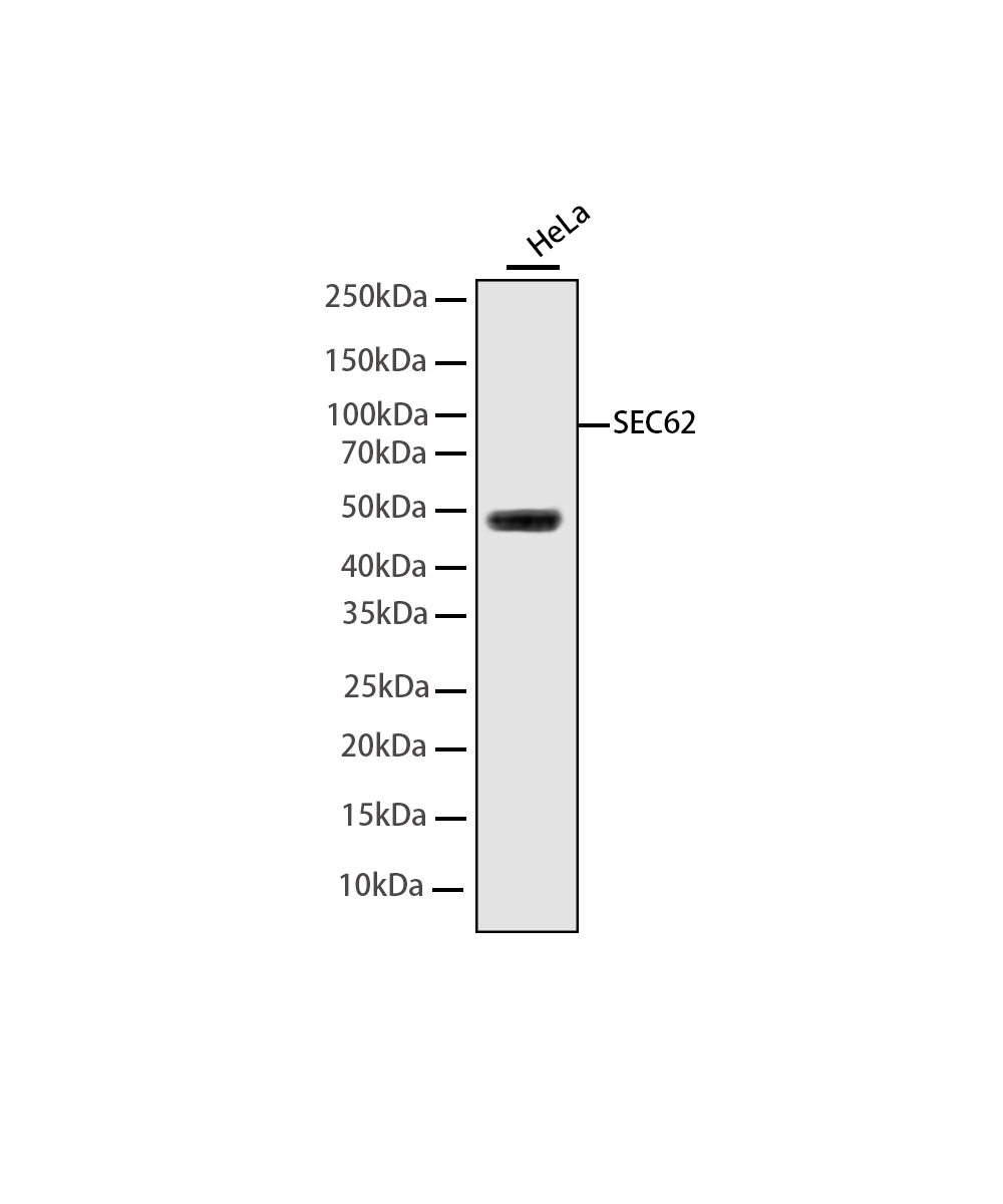 Rabbit monoclonal antibody