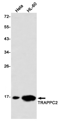 Rabbit monoclonal antibody