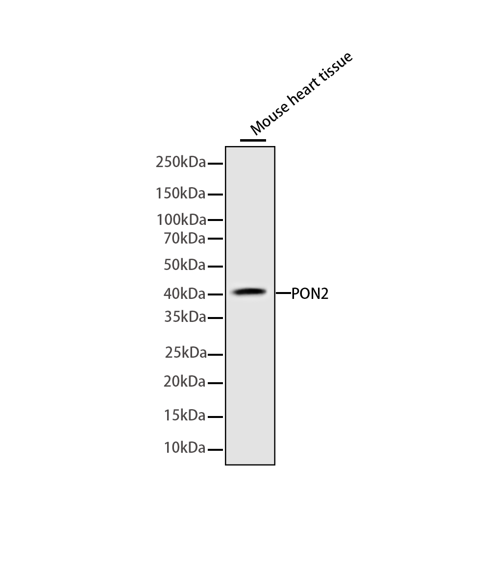 Rabbit monoclonal antibody