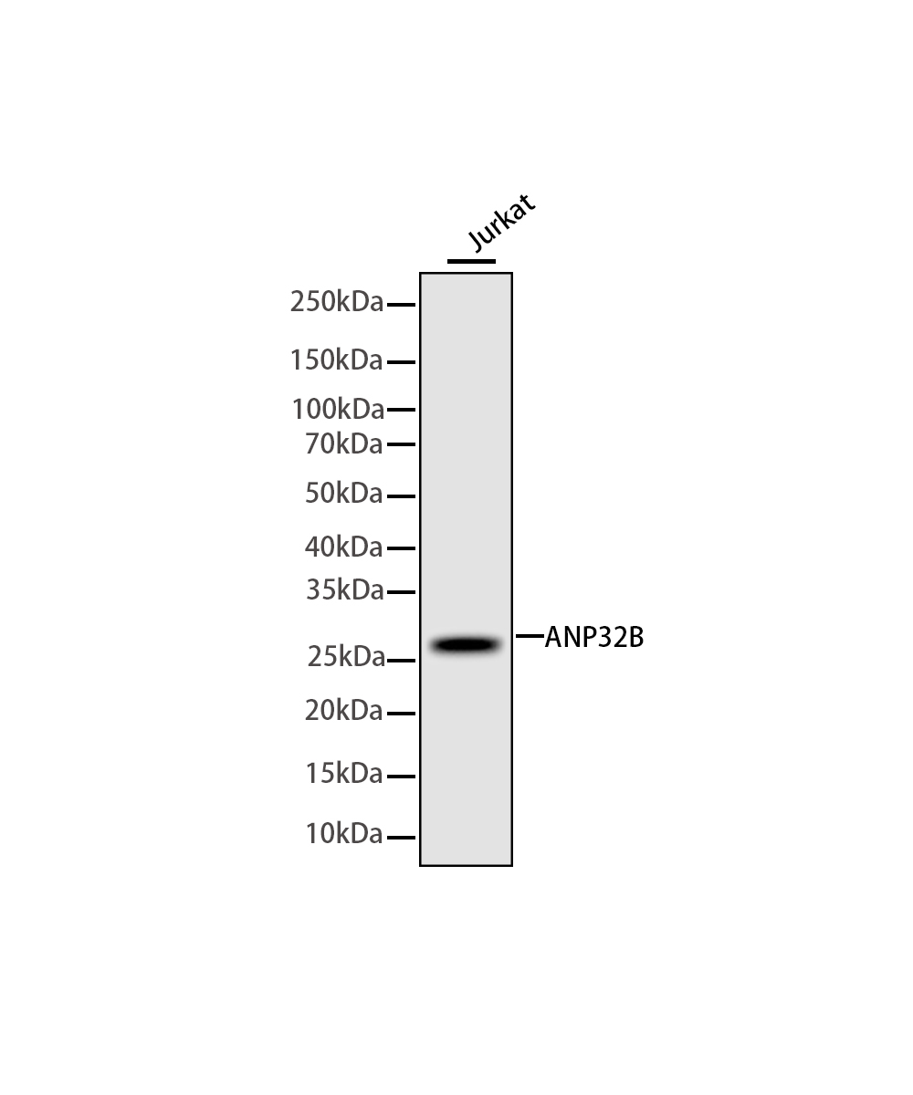 Rabbit monoclonal antibody