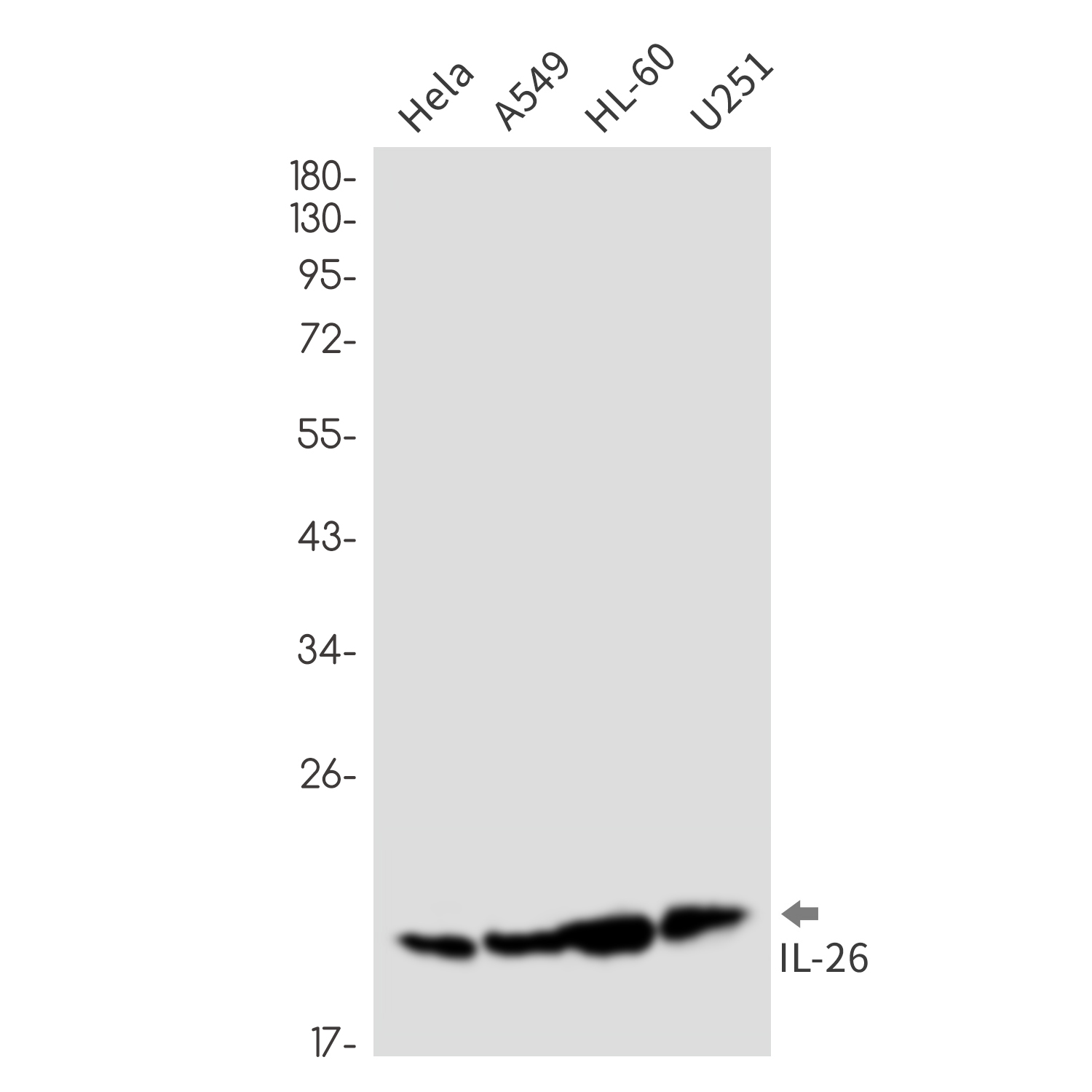 Rabbit monoclonal antibody