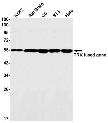 Rabbit monoclonal antibody