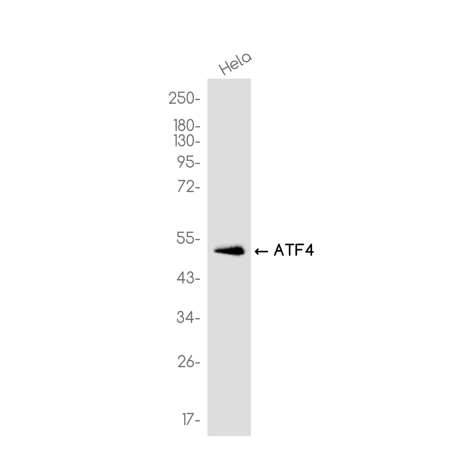 Rabbit monoclonal antibody