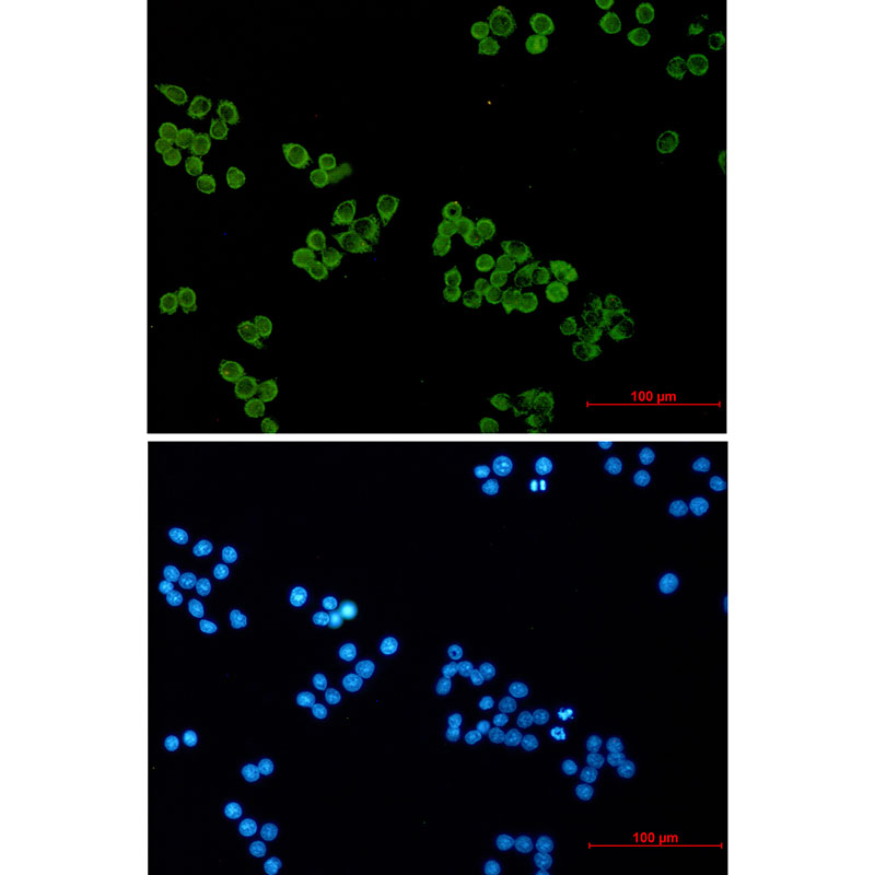 Rabbit monoclonal antibody