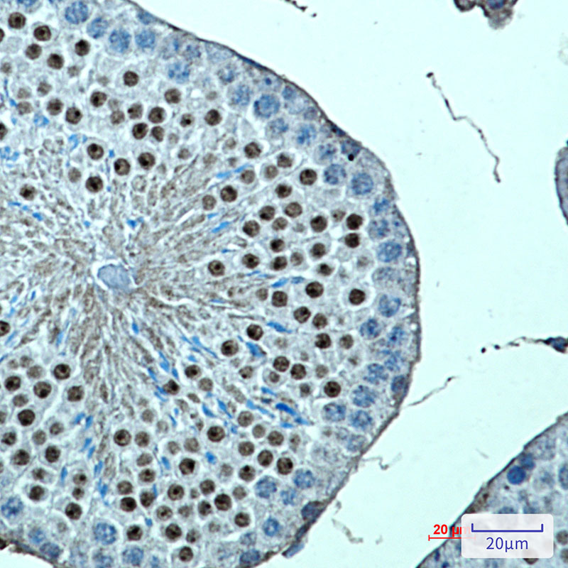 Rabbit monoclonal antibody