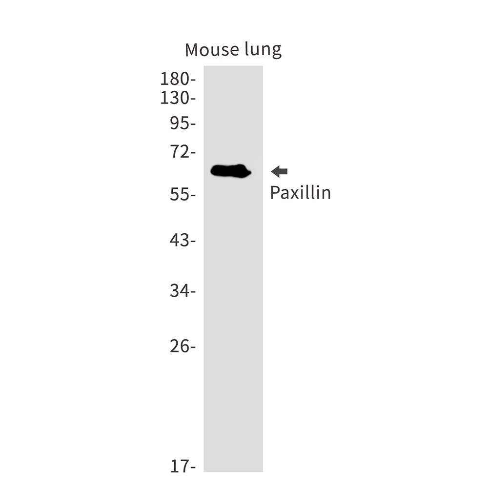 Rabbit monoclonal antibody