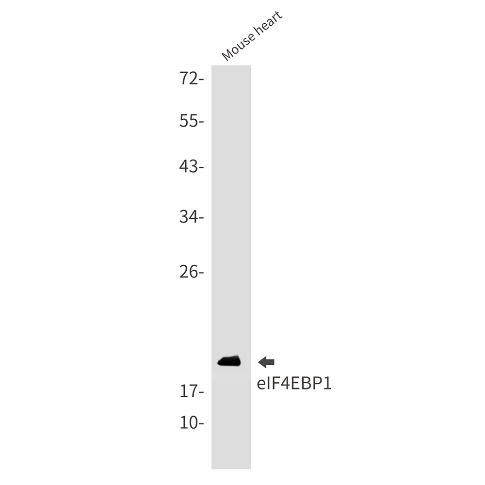Rabbit monoclonal antibody