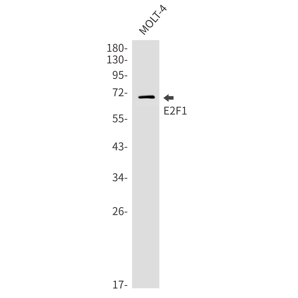 Rabbit monoclonal antibody