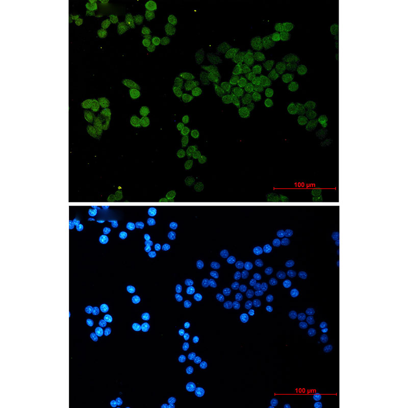 Rabbit monoclonal antibody