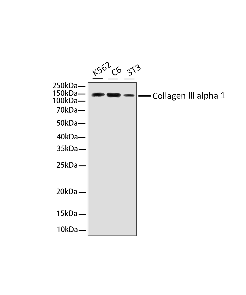 Rabbit monoclonal antibody