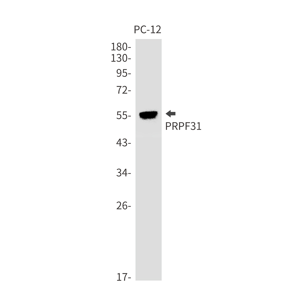 Rabbit monoclonal antibody