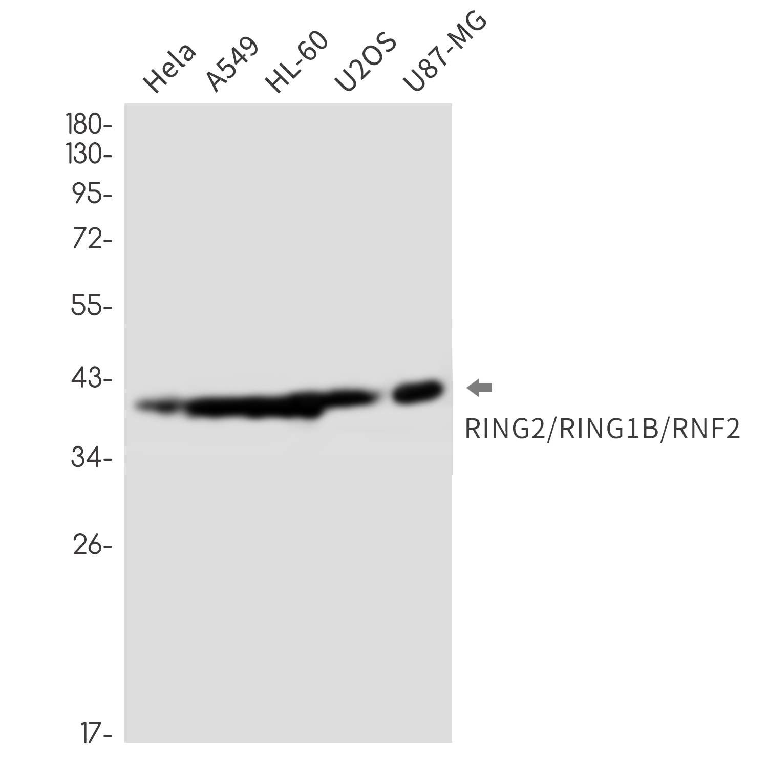 Rabbit monoclonal antibody
