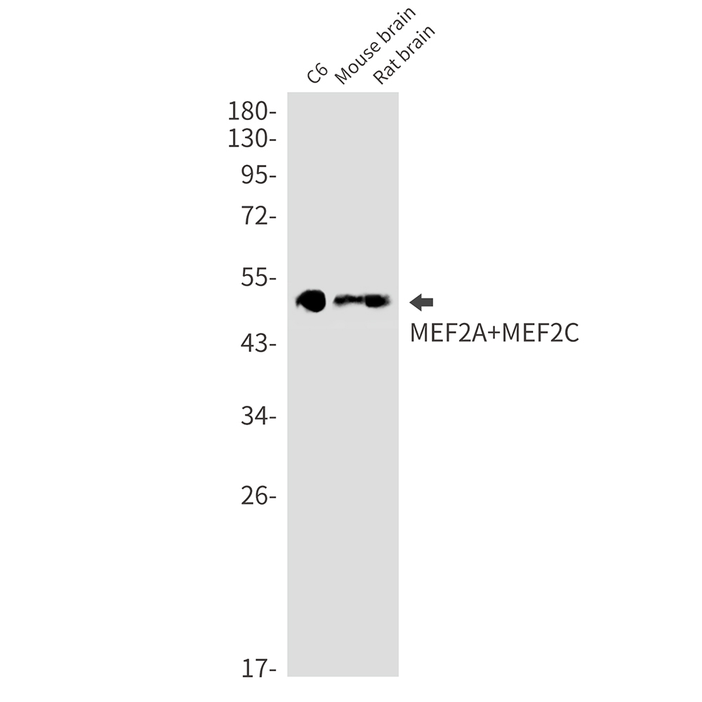 Rabbit monoclonal antibody
