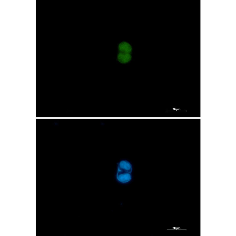 Rabbit monoclonal antibody