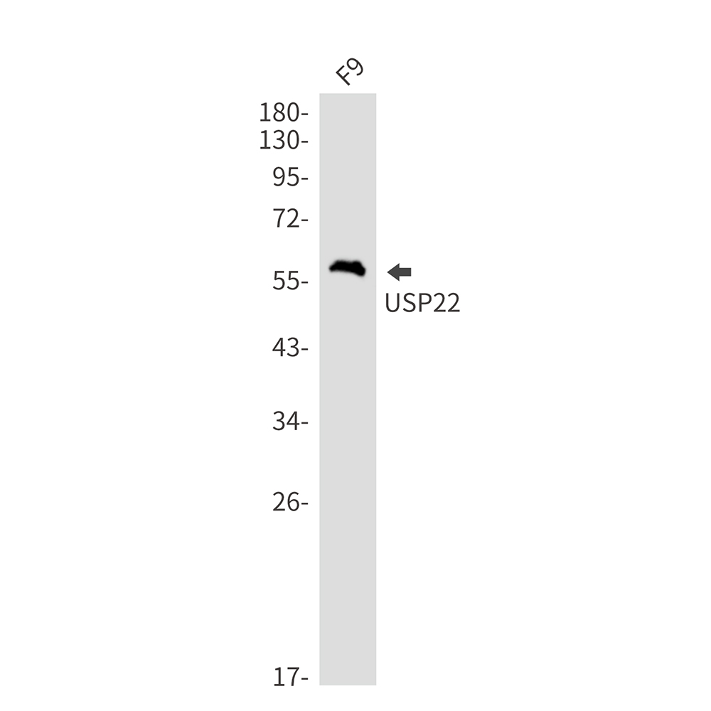 Rabbit monoclonal antibody