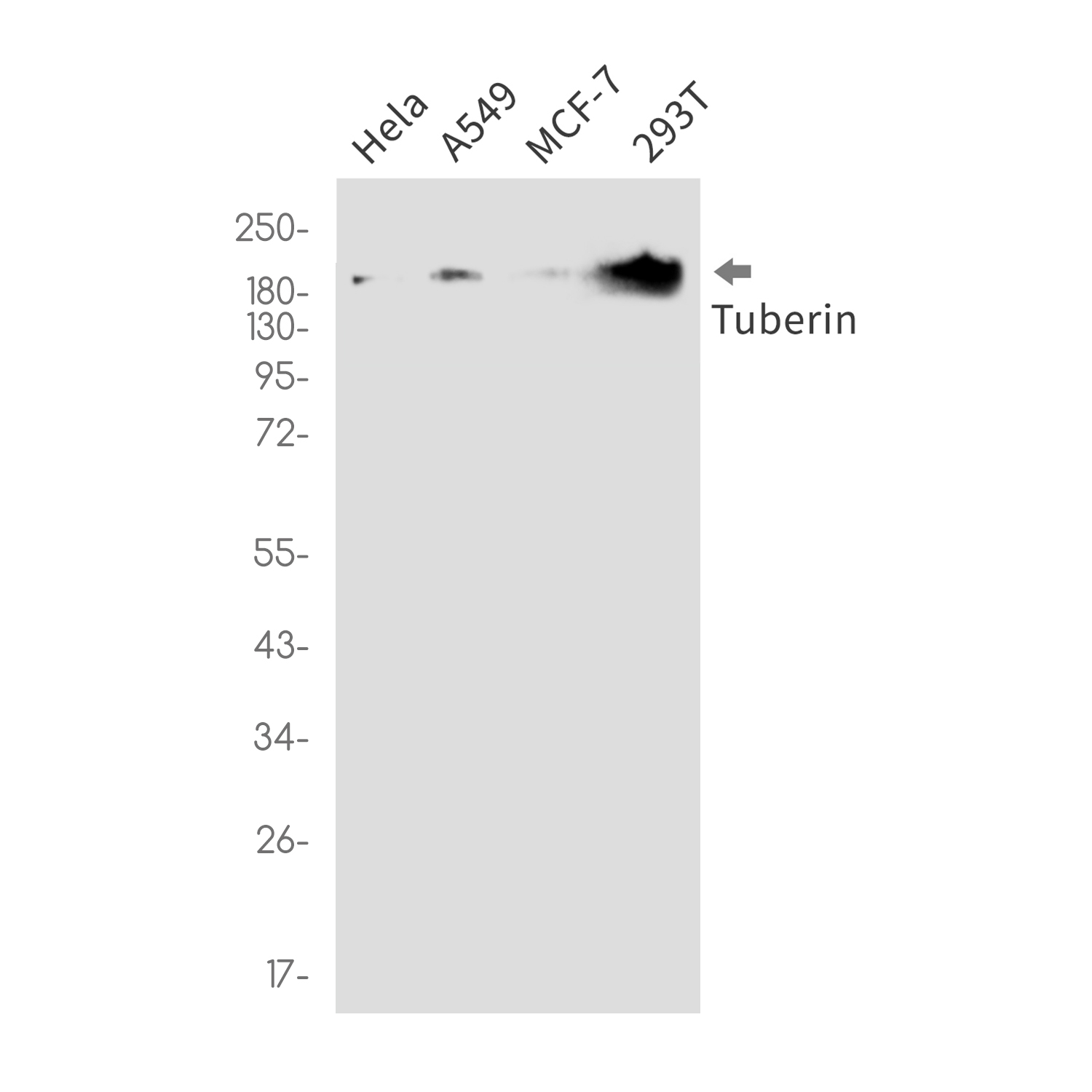 Rabbit monoclonal antibody