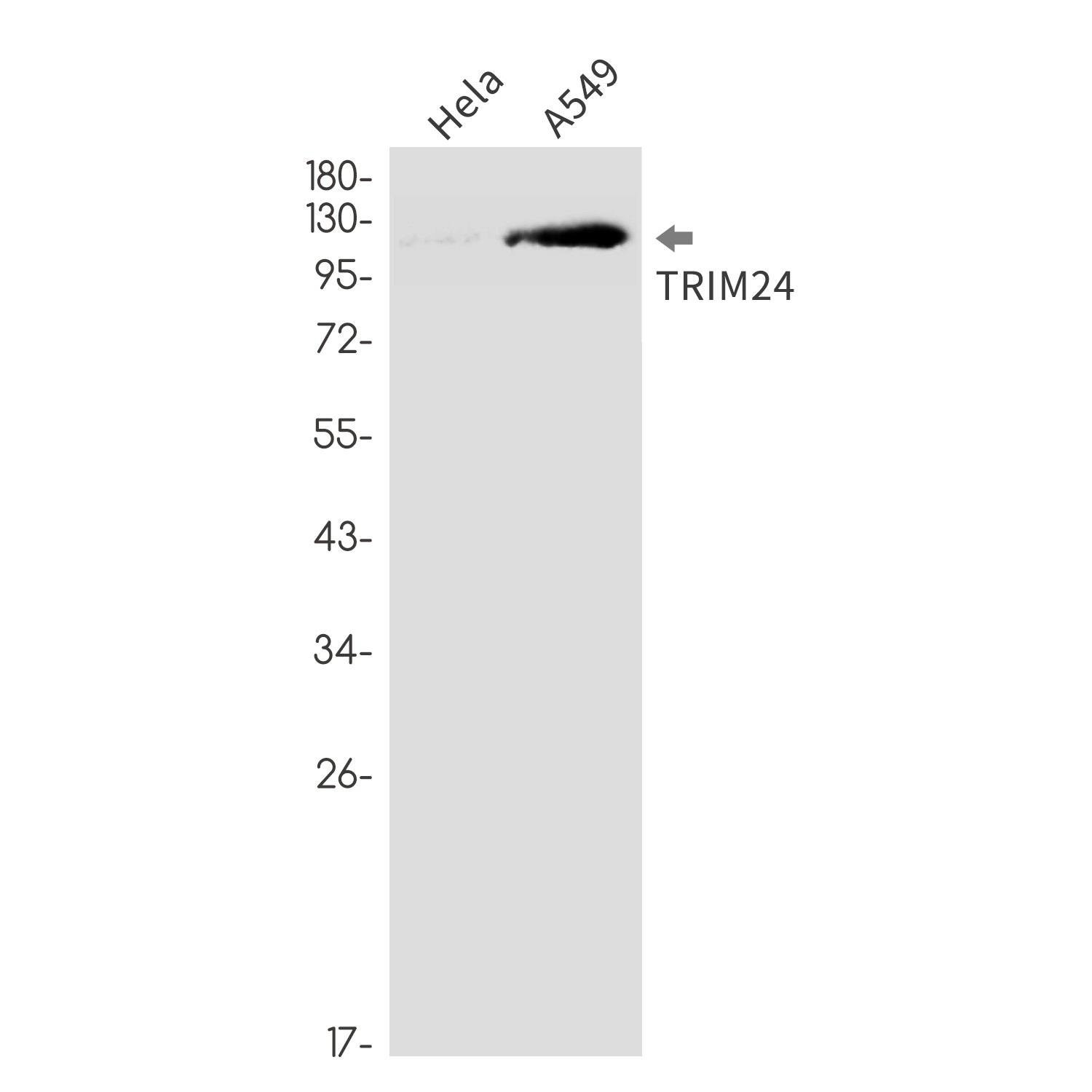 Rabbit monoclonal antibody
