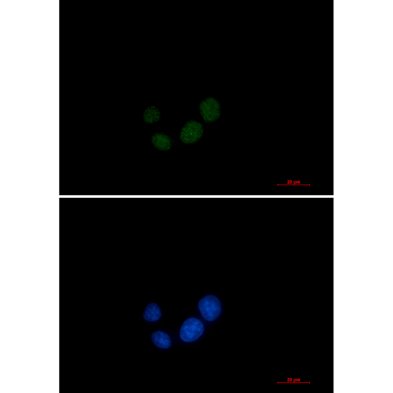 Rabbit monoclonal antibody