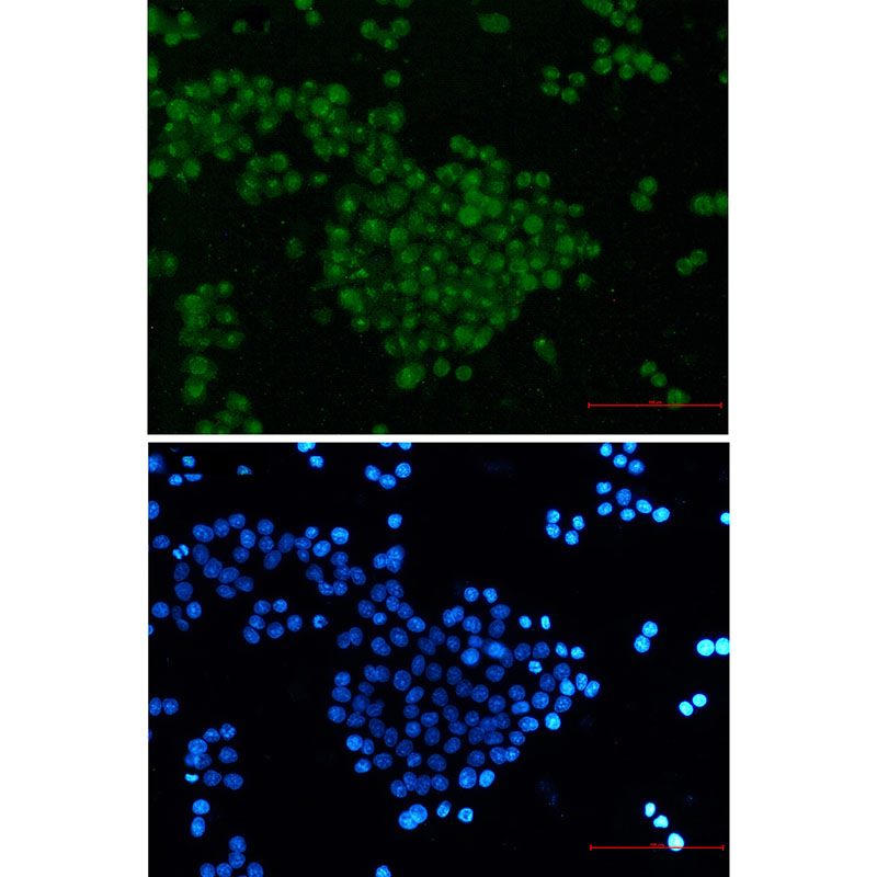 Rabbit monoclonal antibody