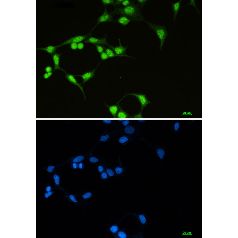 Rabbit monoclonal antibody