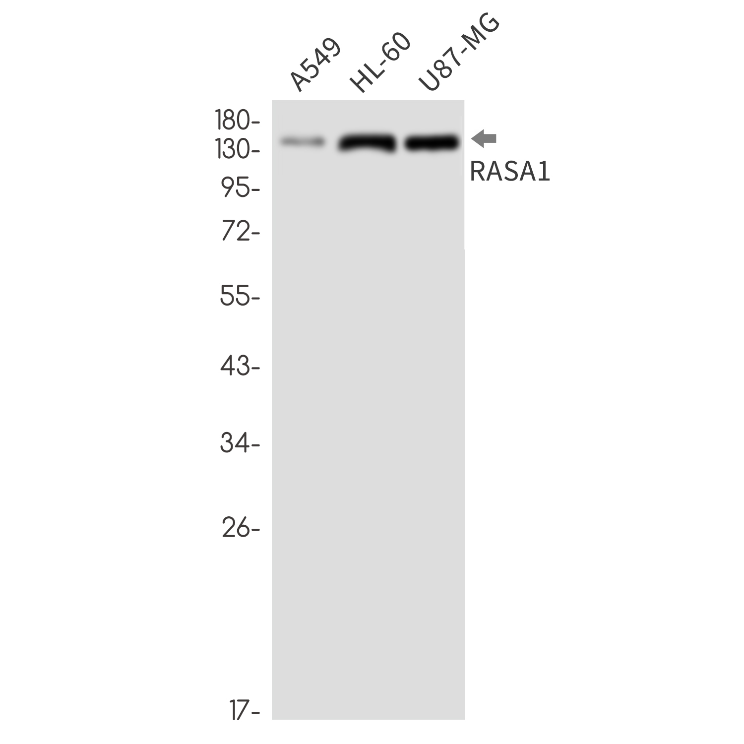 Rabbit monoclonal antibody