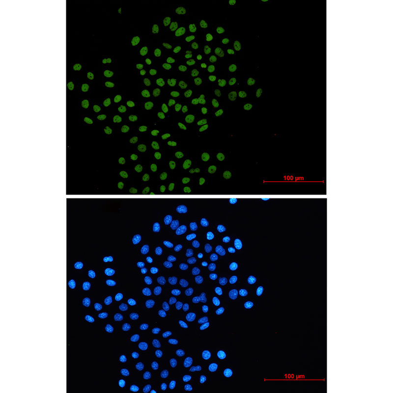 Rabbit monoclonal antibody