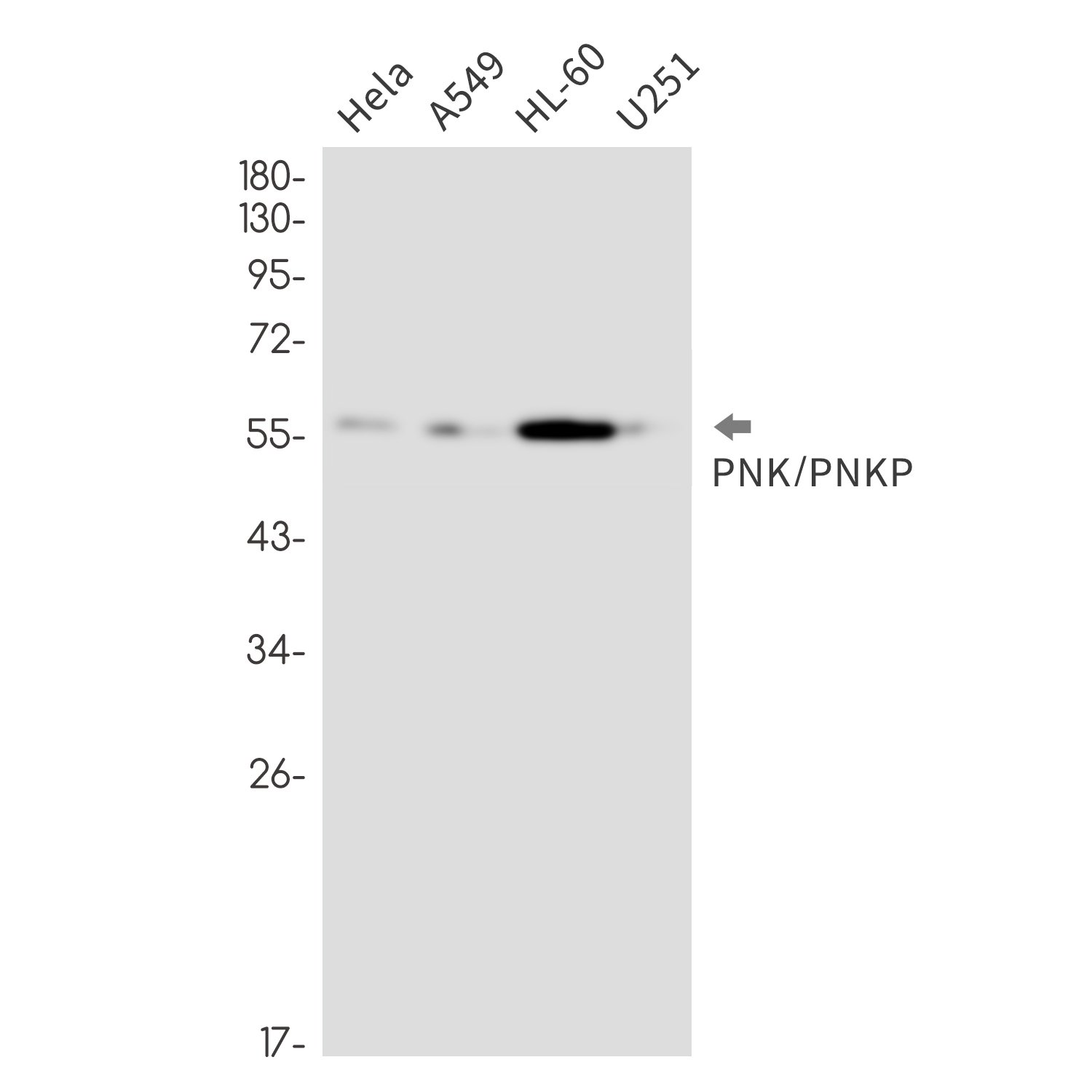 Rabbit monoclonal antibody