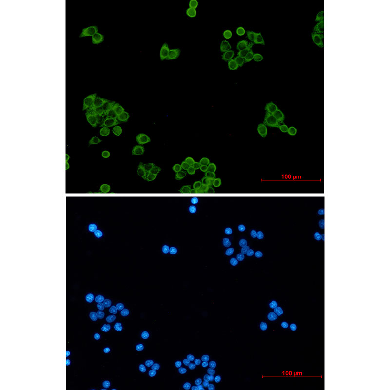 Rabbit monoclonal antibody