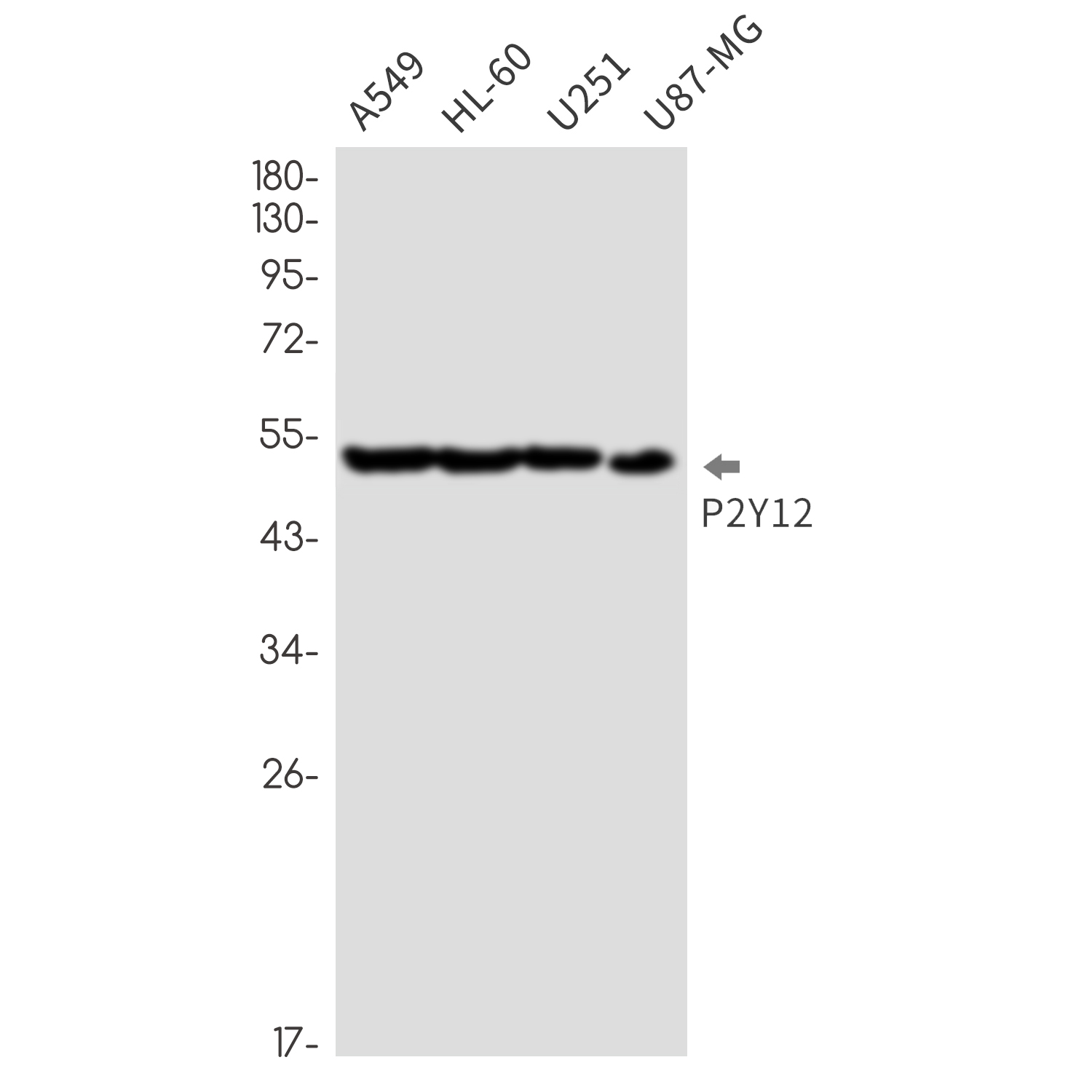 Rabbit monoclonal antibody