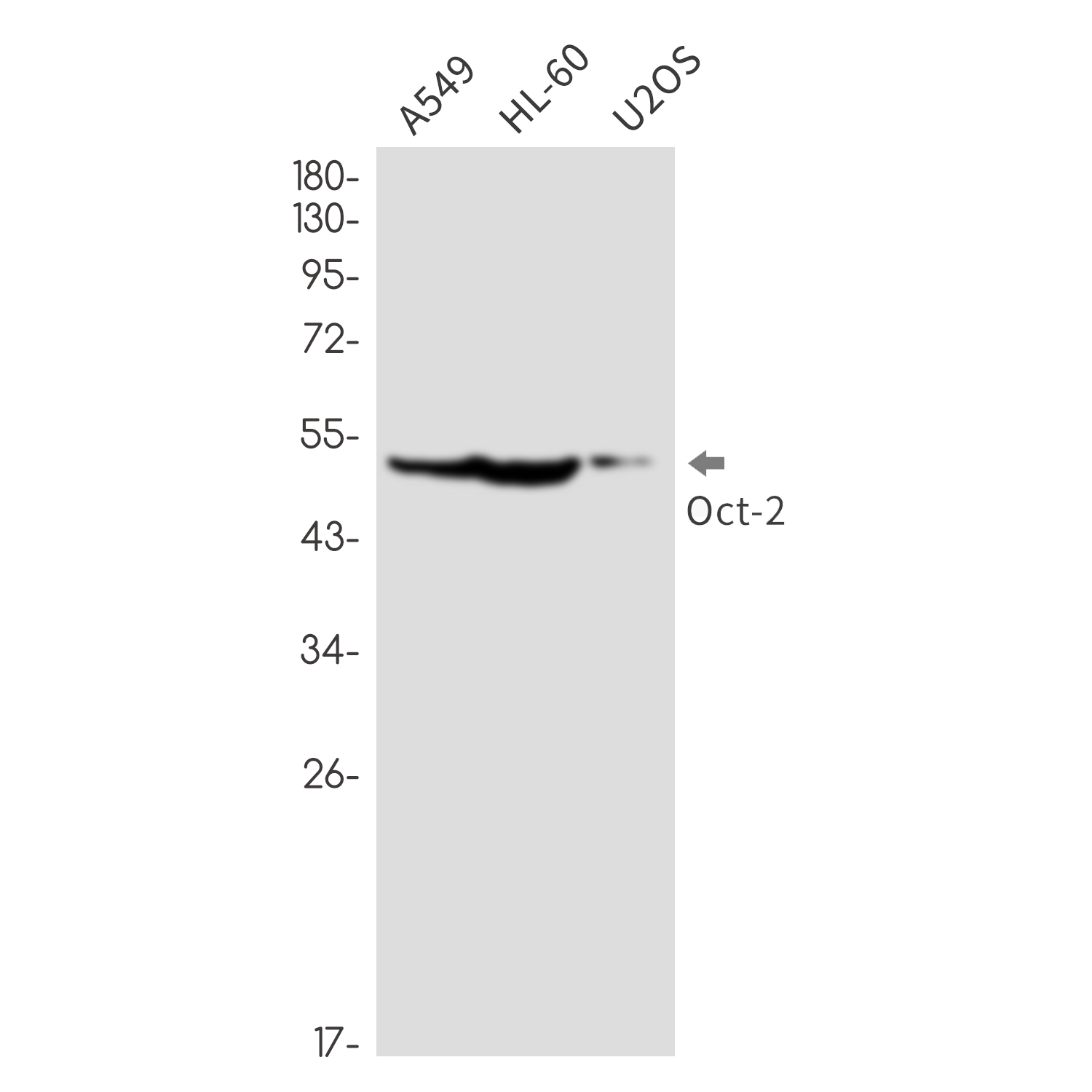Rabbit monoclonal antibody