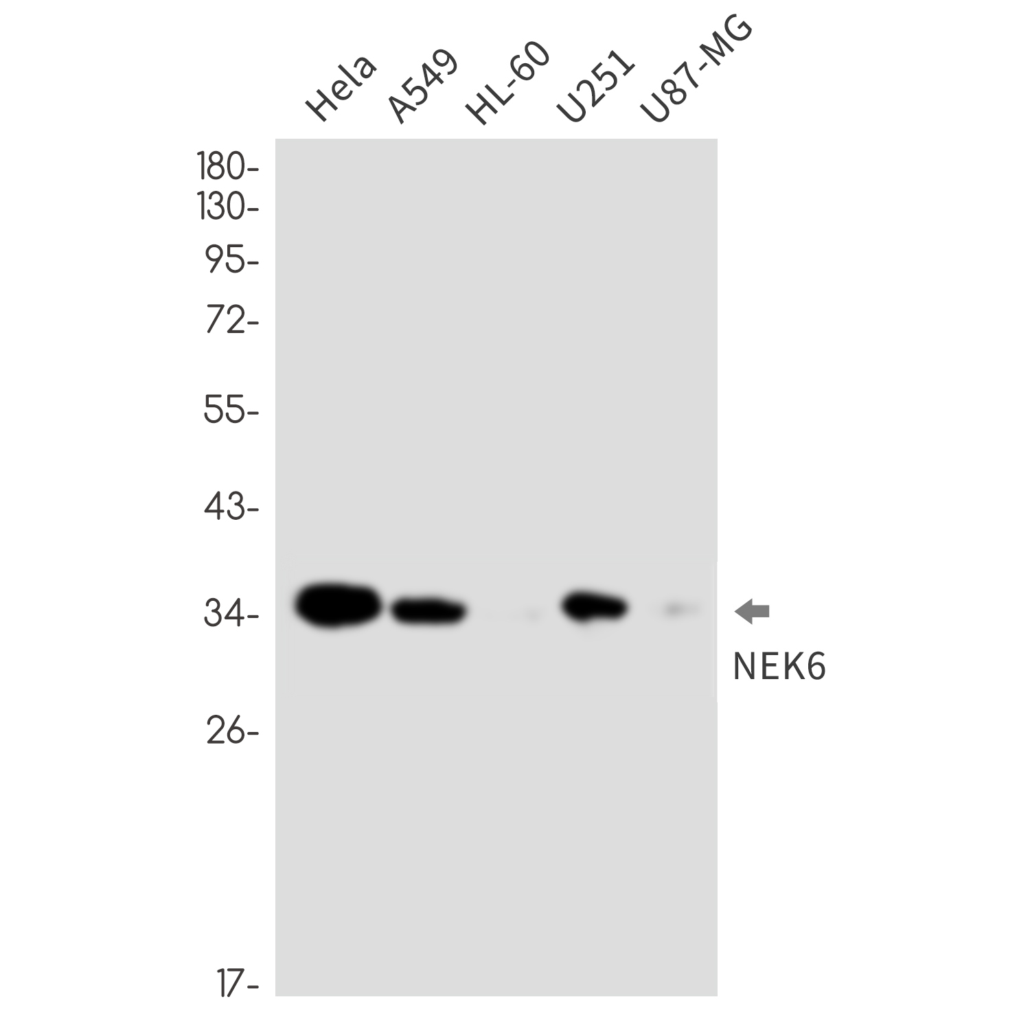 Rabbit monoclonal antibody