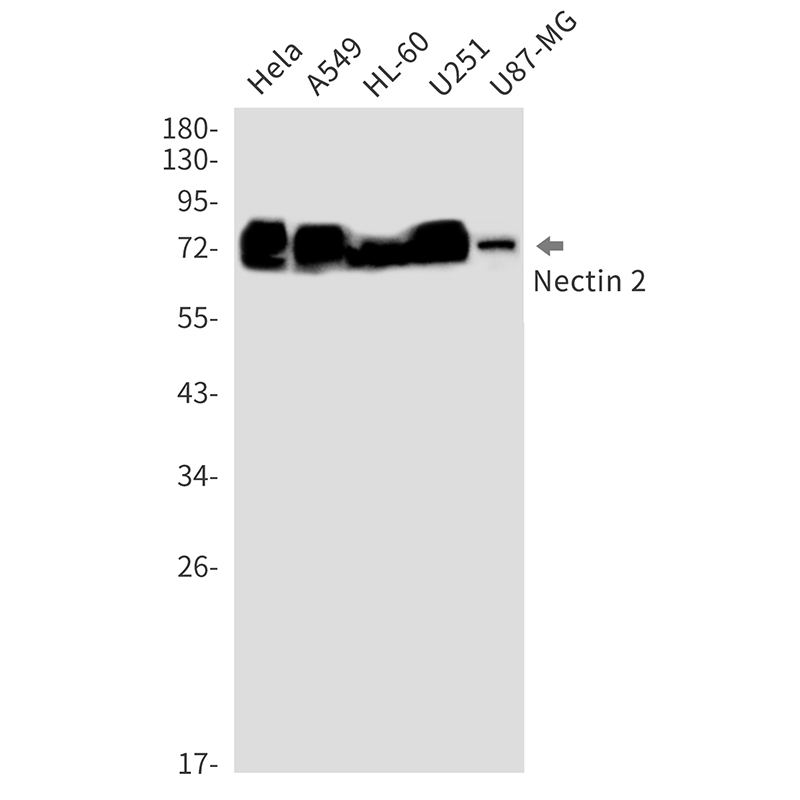 Rabbit monoclonal antibody