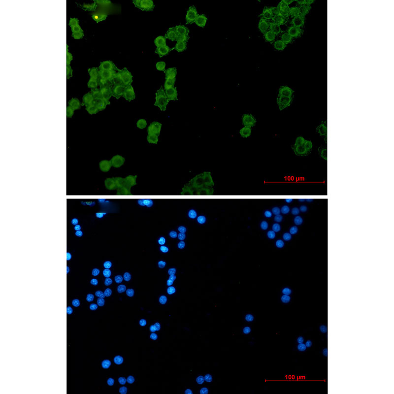 Rabbit monoclonal antibody