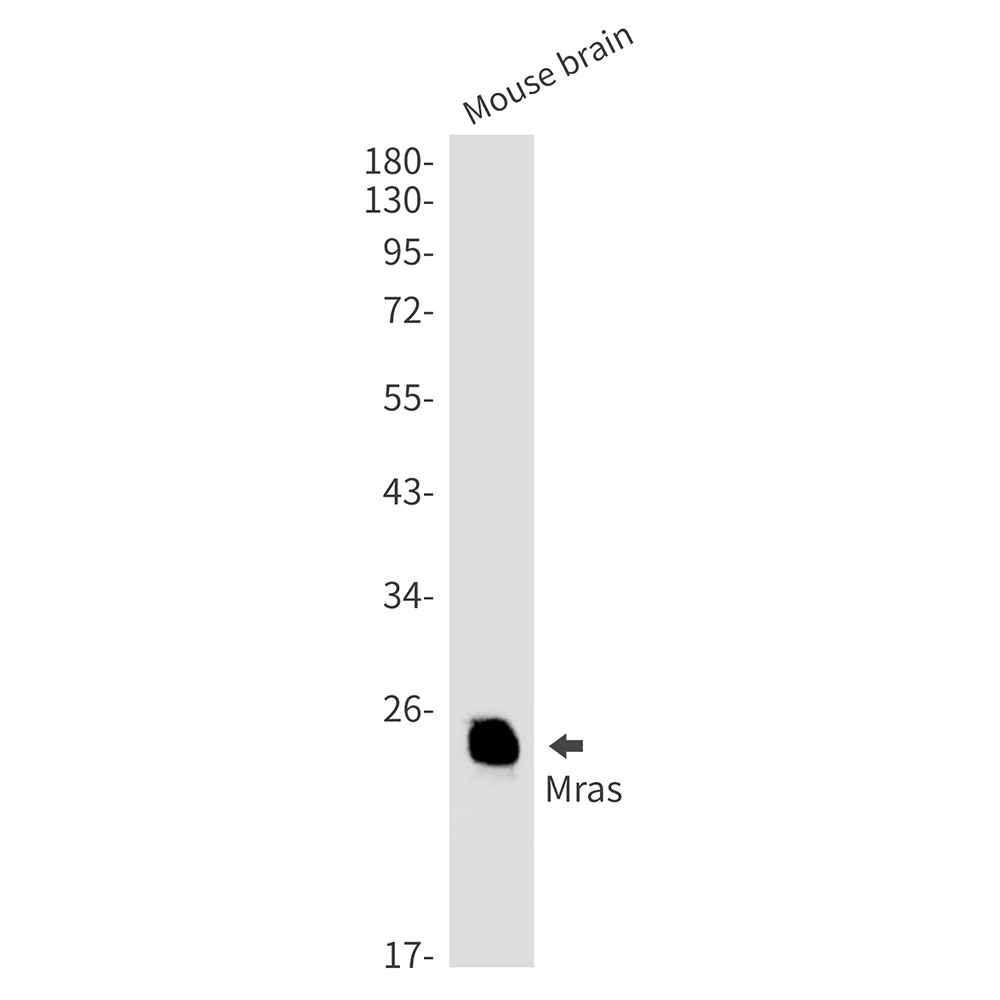 Rabbit monoclonal antibody