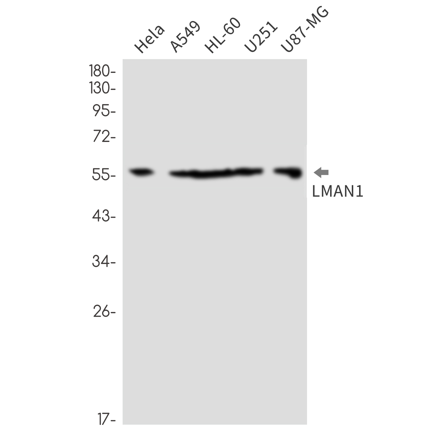 Rabbit monoclonal antibody