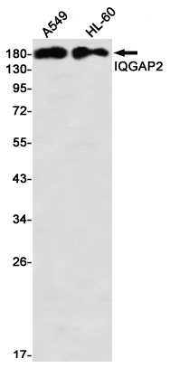 Rabbit monoclonal antibody