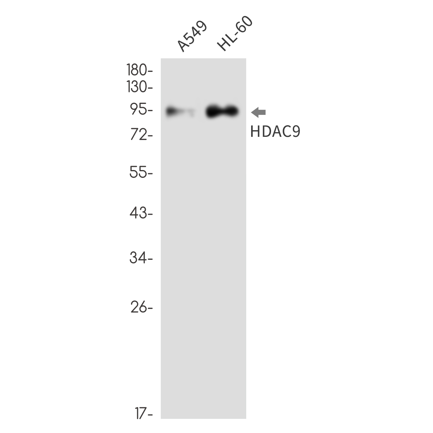 Rabbit monoclonal antibody