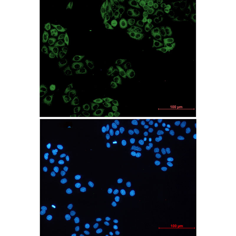 Rabbit monoclonal antibody